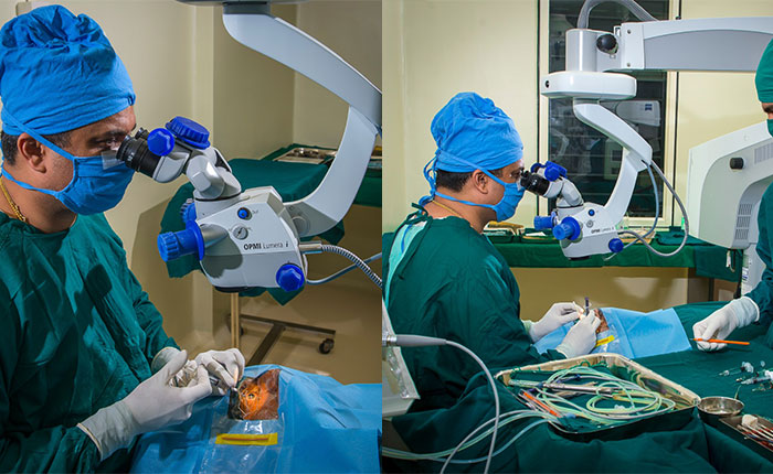 Cataract-Surgery Cataract Surgery