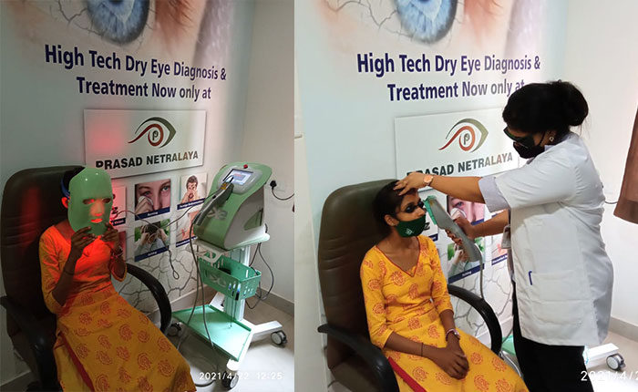 dry-eye-therapy Dry Eye Syndrome