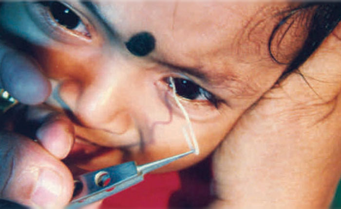 Paediatric-Ophthalmology Paediatric Ophthalmology